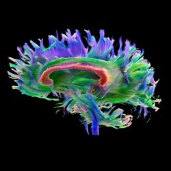 cerveau cerveau